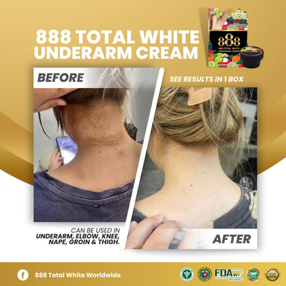 AUTHENTIC FROM THAILAND! 888 UNDERARM CREAM