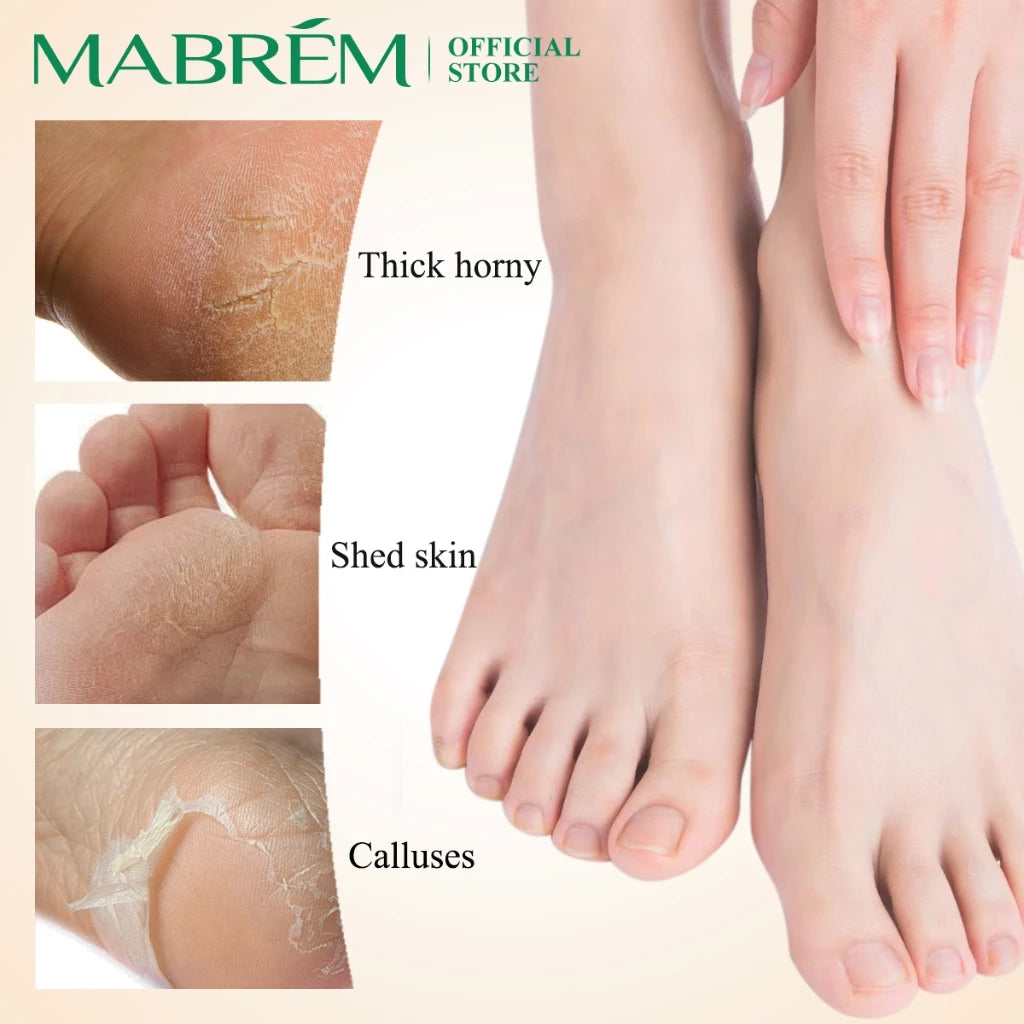 MABREM【FDA】Calendula Foot Cream Heel Crack Repair Cream Specially Treats Cracked Heels, Dry, Hard Skin, and Peeling on the Soles