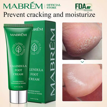 MABREM【FDA】Calendula Foot Cream Heel Crack Repair Cream Specially Treats Cracked Heels, Dry, Hard Skin, and Peeling on the Soles