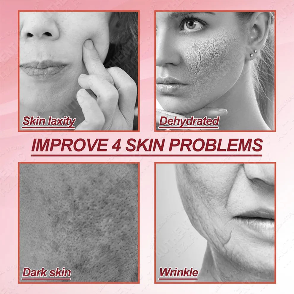 Retinol Cream Dragon Blood Cream Whitening Moisturizing Melasma Remover Ance Freckles Remover 50g