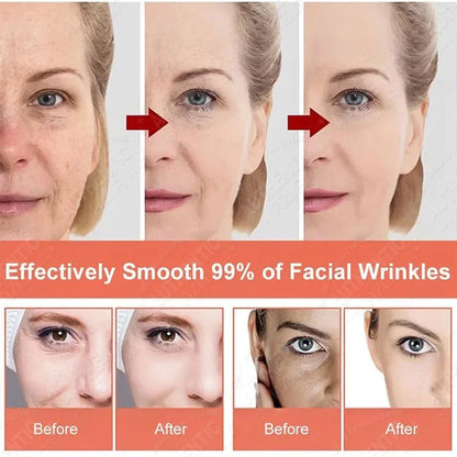 Retinol Cream Dragon Blood Cream Whitening Moisturizing Melasma Remover Ance Freckles Remover 50g