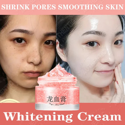 Retinol Cream Dragon Blood Cream Whitening Moisturizing Melasma Remover Ance Freckles Remover 50g