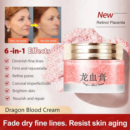 Retinol Cream Dragon Blood Cream Whitening Moisturizing Melasma Remover Ance Freckles Remover 50g